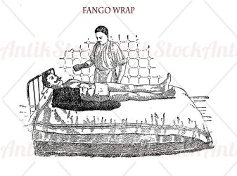 Fango wrap treatment